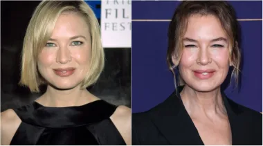 Glumica Renée Zellweger učvrstila je svoje mjesto u Hollywoodu zahvaljujući uspješnoj, desetljećima dugoj karijeri s filmovima poput "Jerryja Maguirea", "Dnevnika Bridget Jones", "Judy" i drugih. Njezina transformacija tijekom godina dovela je do nagađanja o plastičnim operacijama, iako ona sama to nikada nije priznala, već zanijekala. No, bilo da je promijenila nešto na sebi ili ne, definitivno izgleda drugačije.