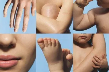 Njega koja obnavlja osjetljiva, nadražena područja