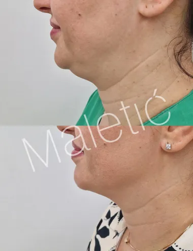 'Razmjena iskustava doprinosi napretku u svakom pogledu i unapređuje kolegijalnost'